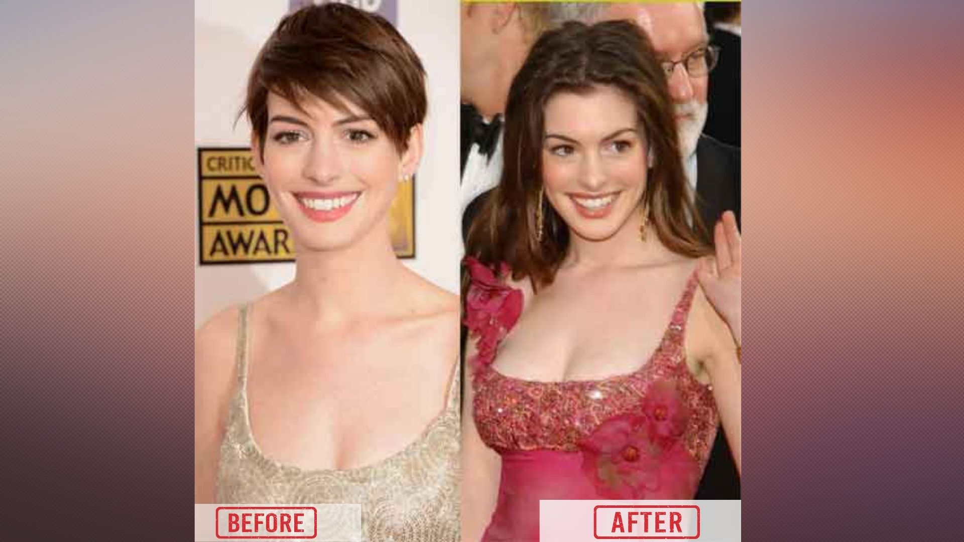 Anne Hathaway breast Surgery