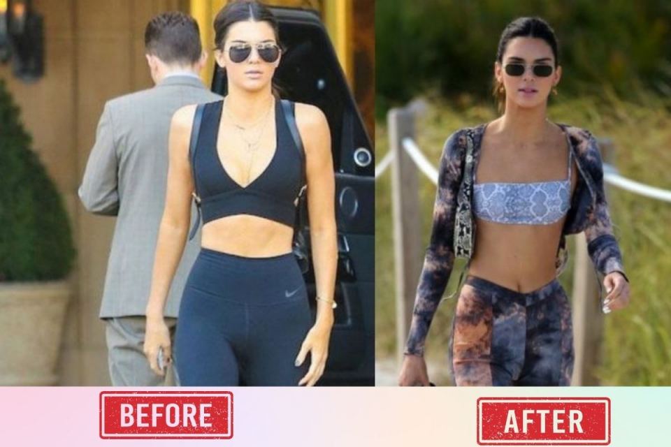 Kendall Jenner Before & After