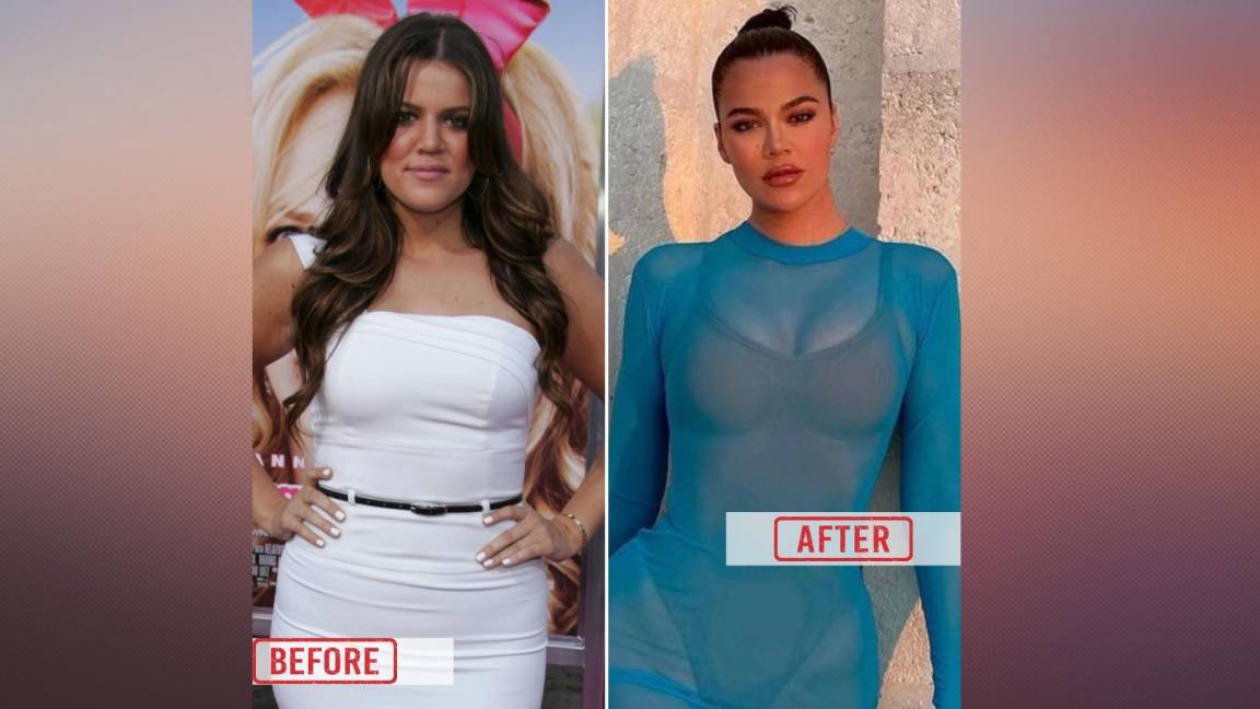 Khloe Kardashian's Before & After