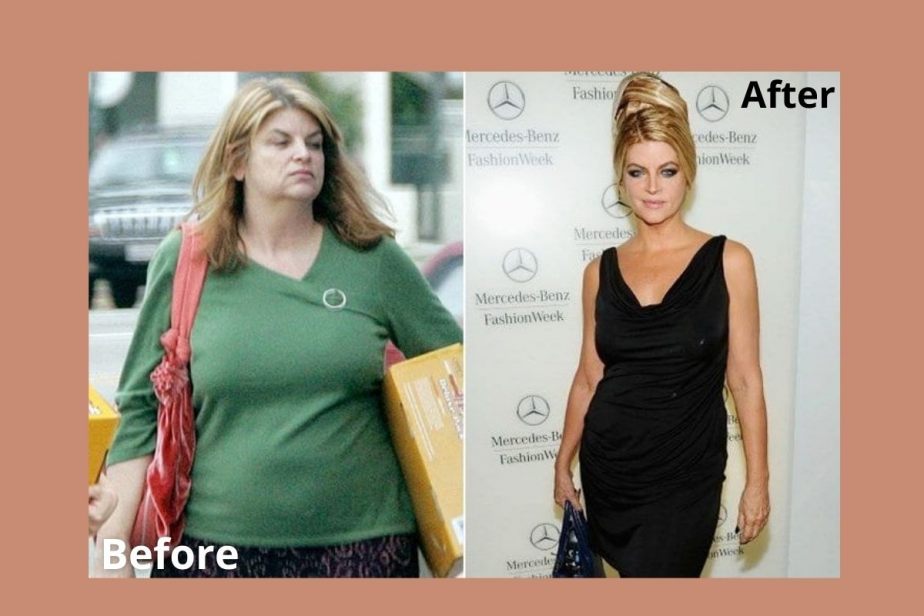 Kirstie Alley before & after