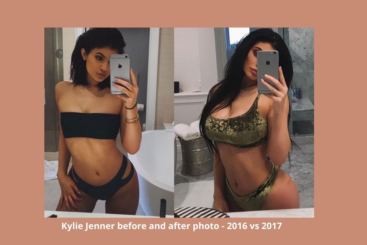 Kylie Jenner before and after photo
