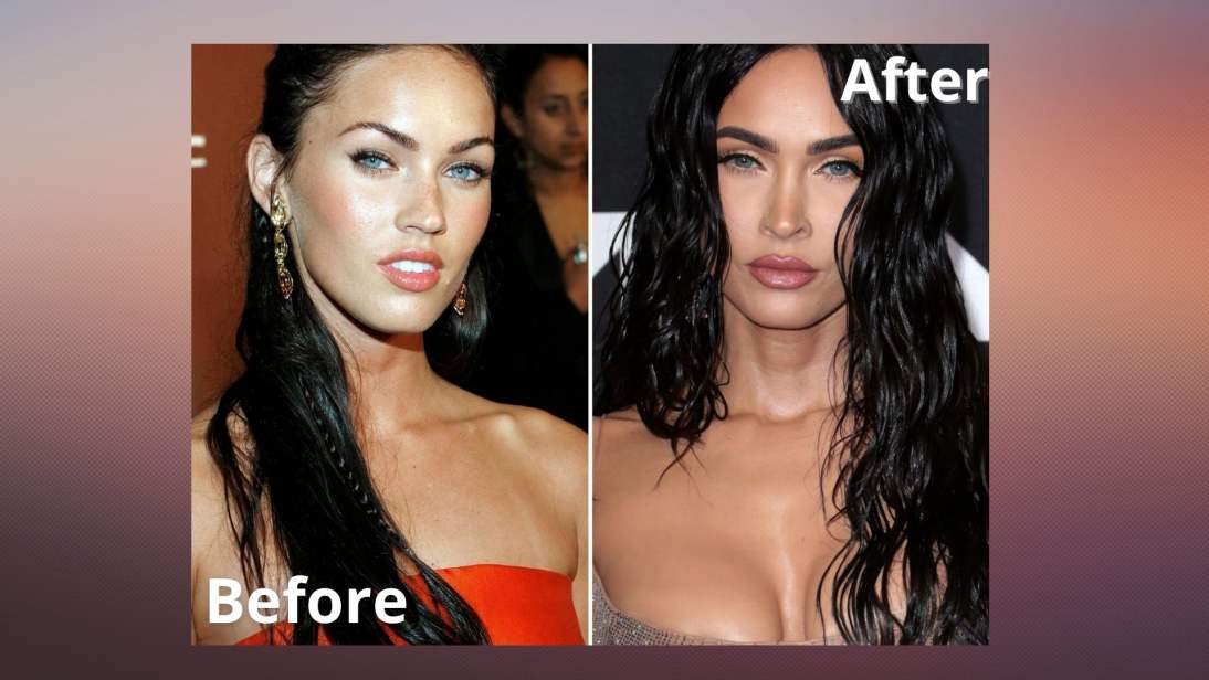 Megan Fox Before And After