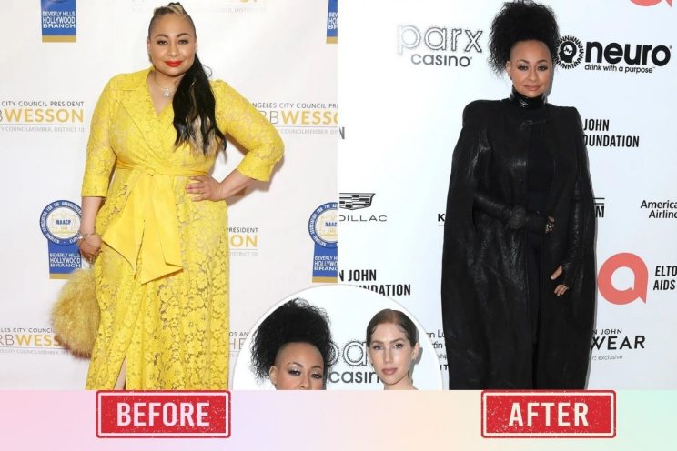 Raven Symone Before & After pictures