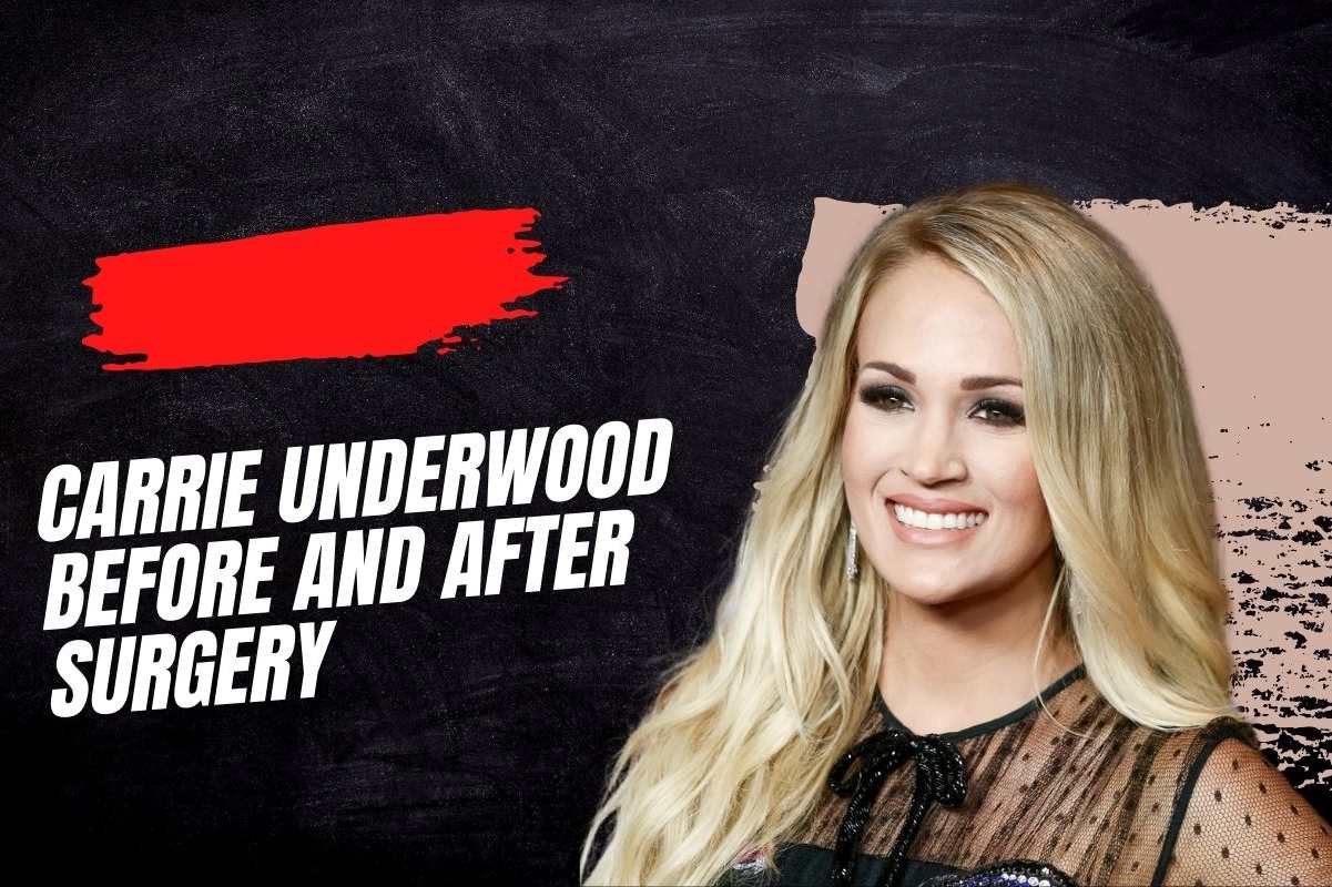 carrie underwood before and after surgery