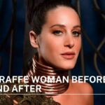 giraffe woman before and after