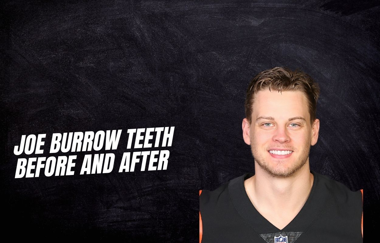 joe burrow teeth before and after