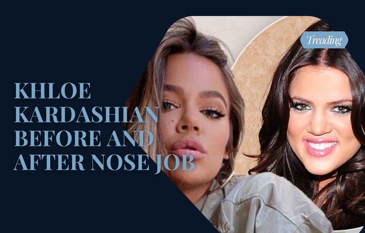 khloe kardashian before and after nose job