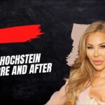 lisa hochstein before and after