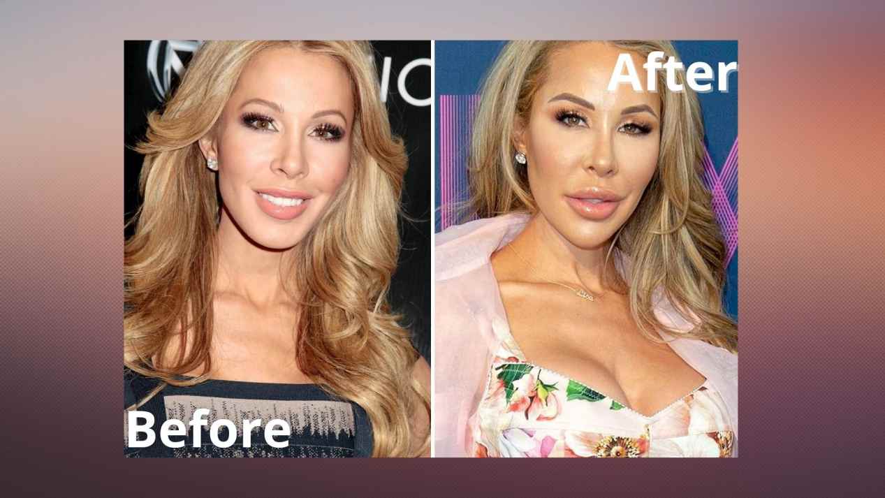 lisa hochstein before and after.