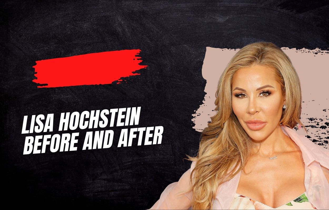 lisa hochstein before and after