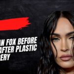 megan fox before and after plastic surgery