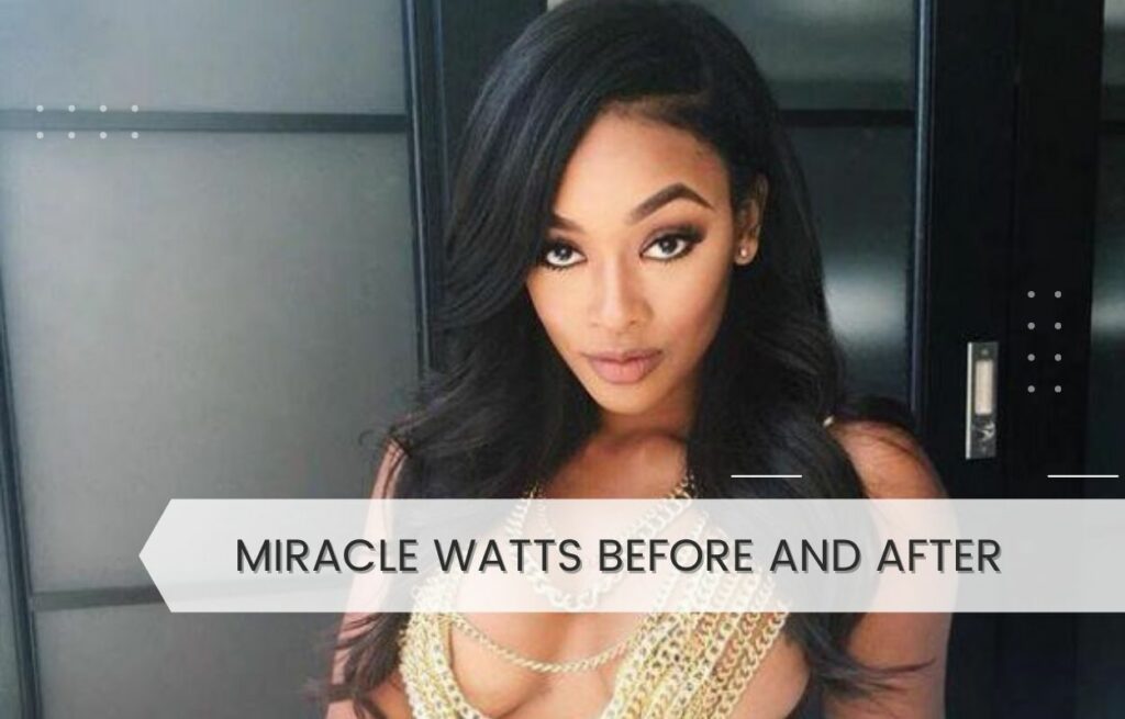 miracle watts before and after