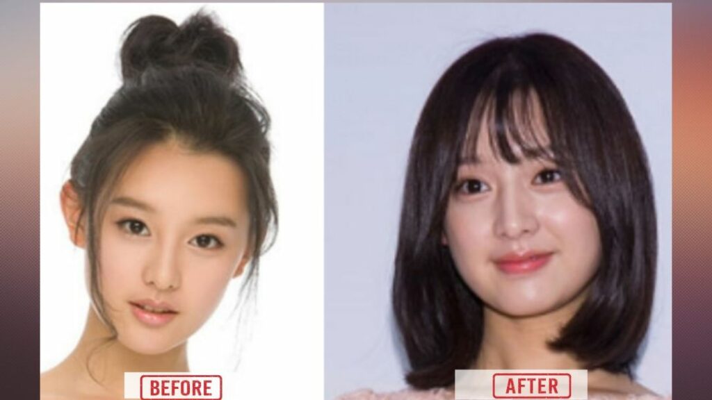 Did Kim Ji Won Undergone Plastic Surgery | Full Transformation Journey