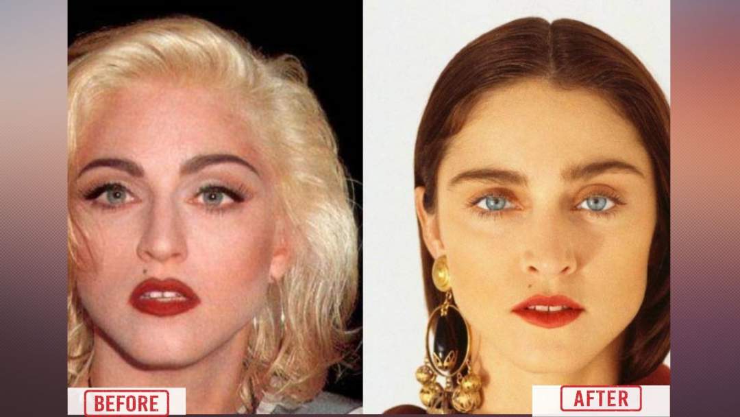 Brow Lift by Madonna