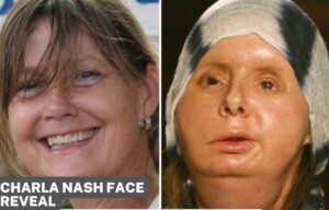 Charla Nash Face Reveal