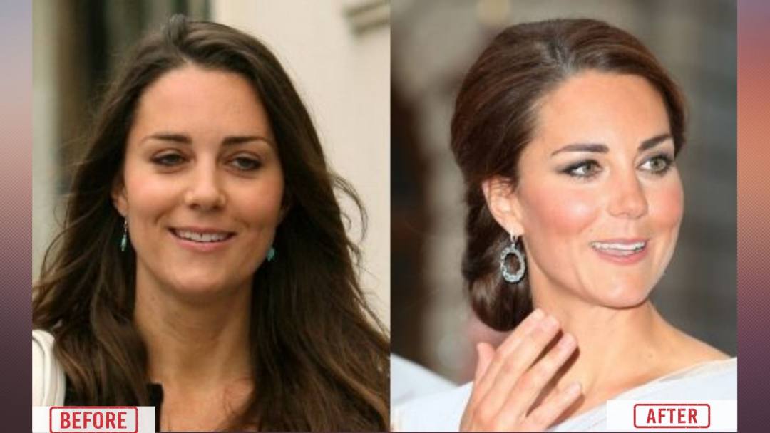 Kate Middleton Before & After