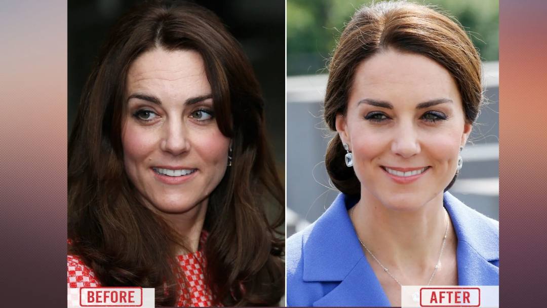 Kate Middleton Before & After Pictures