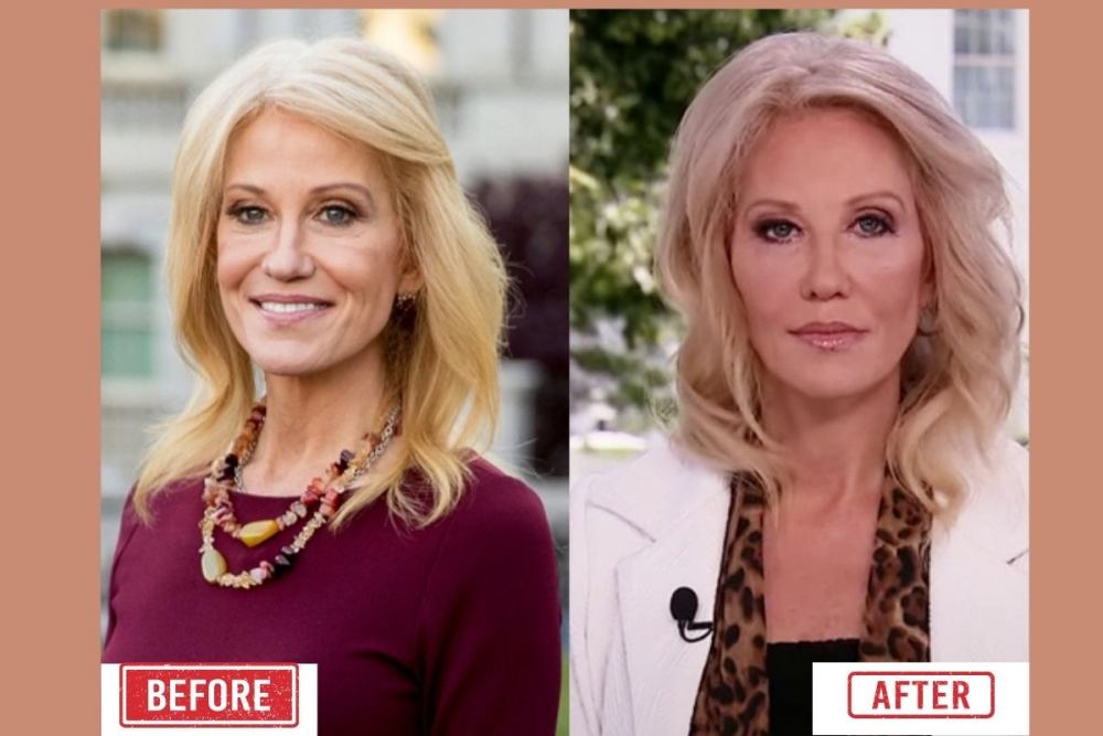 Kelly Anne Conway Before & After Pictures