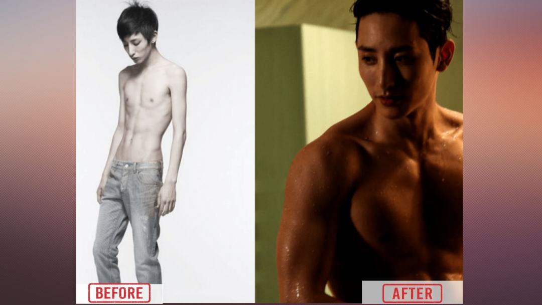 Lee Soo Hyuk Before & After Plastic Surgery 