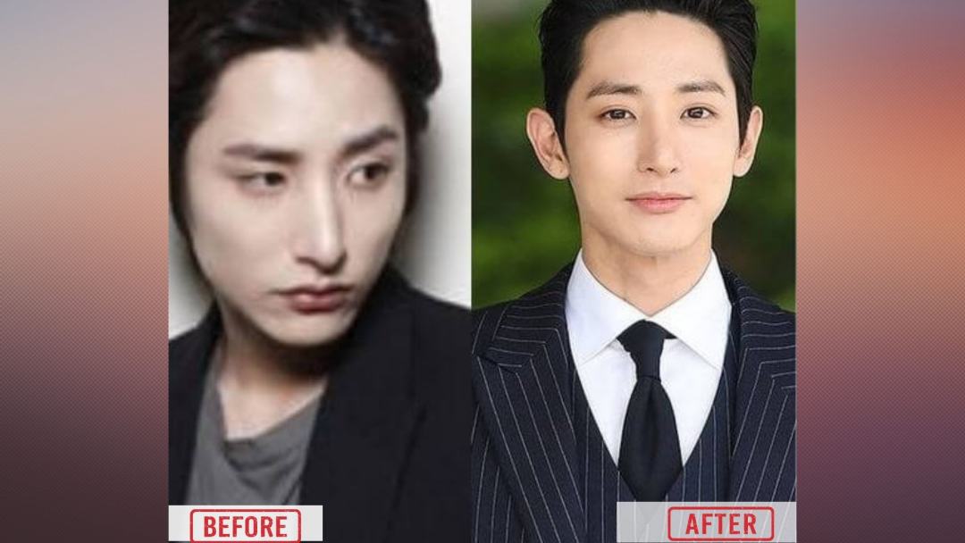 Lee Soo Hyuk Before & After