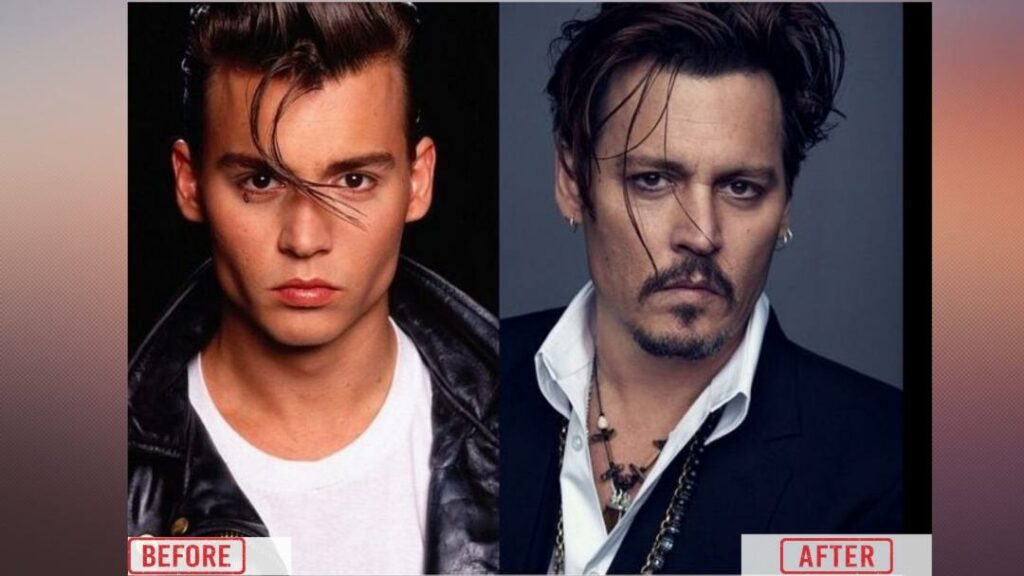 Johnny Depp Before & After Plastic Surgery: Did Johnny Depp Undergone ...