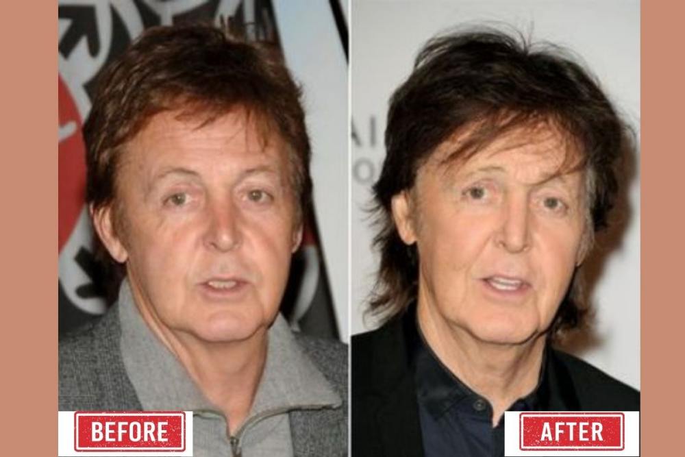 Paul Mccartney Before And After