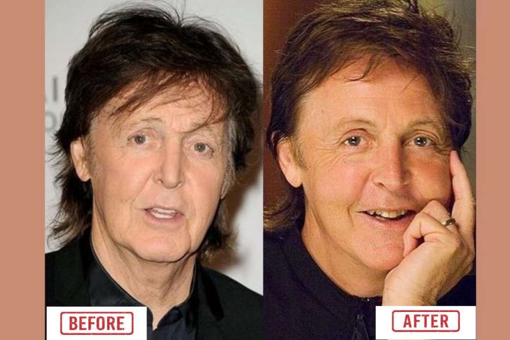Paul Mccartney Before And After Pictures