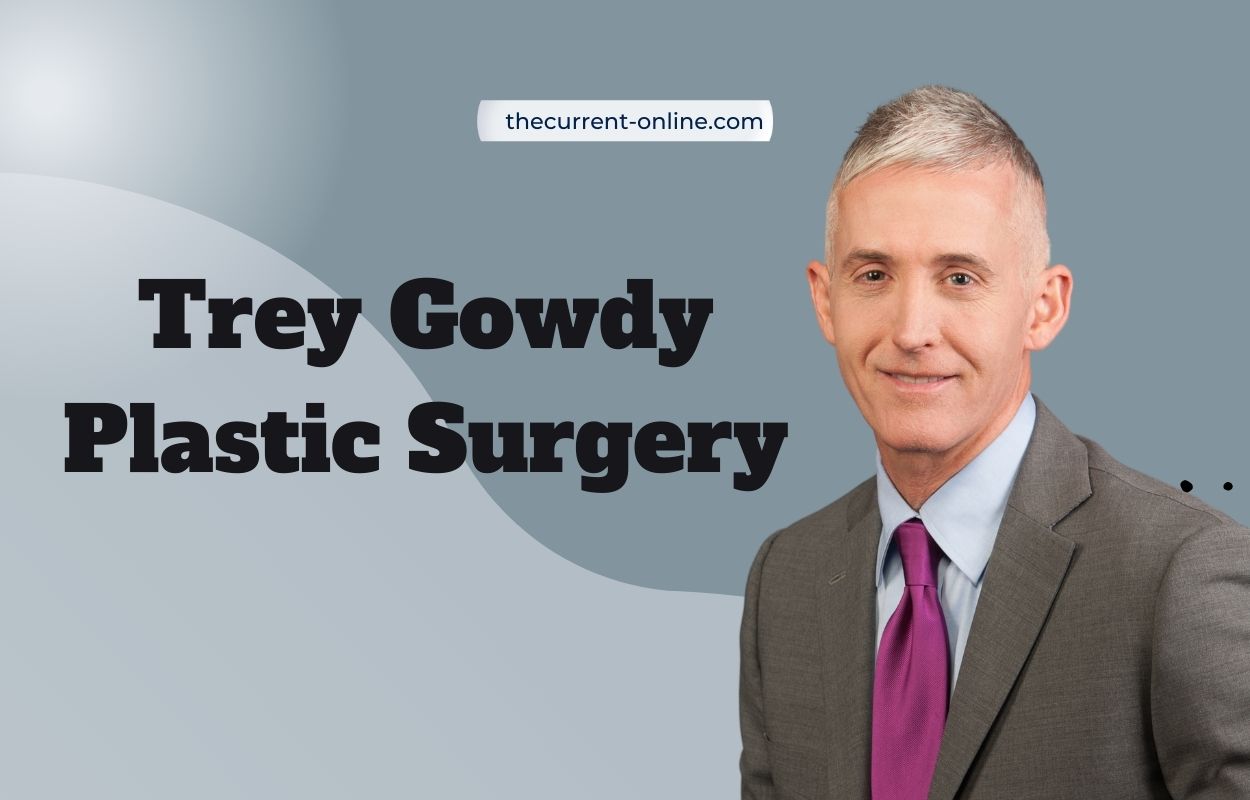 Trey Gowdy Plastic Surgery