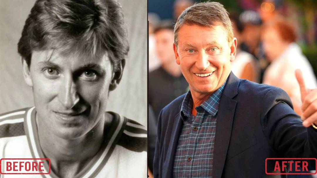 Wayne Gretzky Plastic Surgery Before & After Pictures