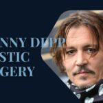johnny depp plastic surgery