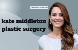 kate middleton plastic surgery