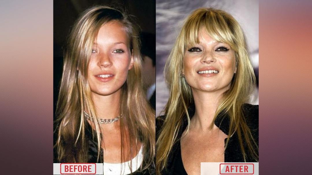 kate moss before & after