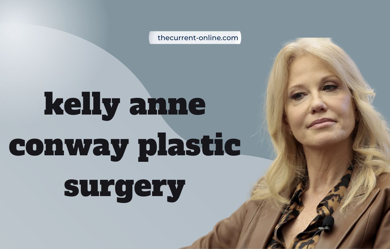 kelly anne conway plastic surgery