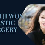 kim ji won plastic surgery