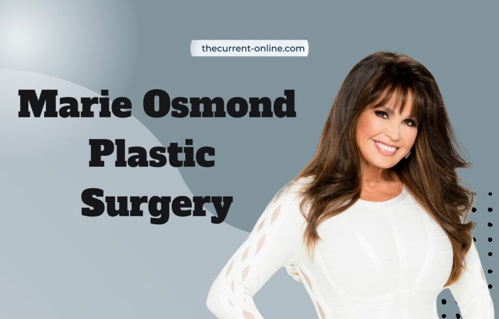 marie osmond plastic surgery