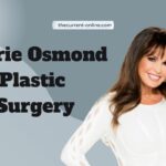 marie osmond plastic surgery