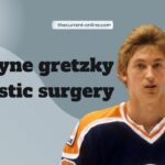 wayne gretzky plastic surgery