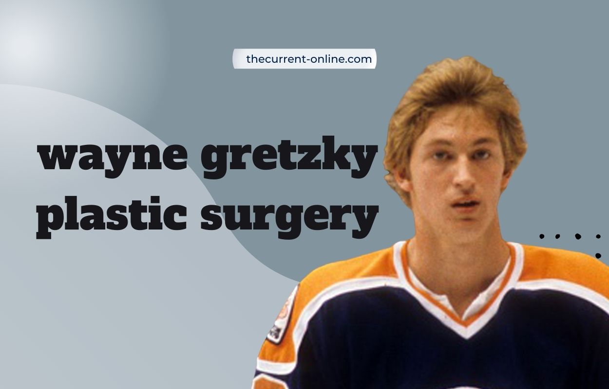 wayne gretzky plastic surgery