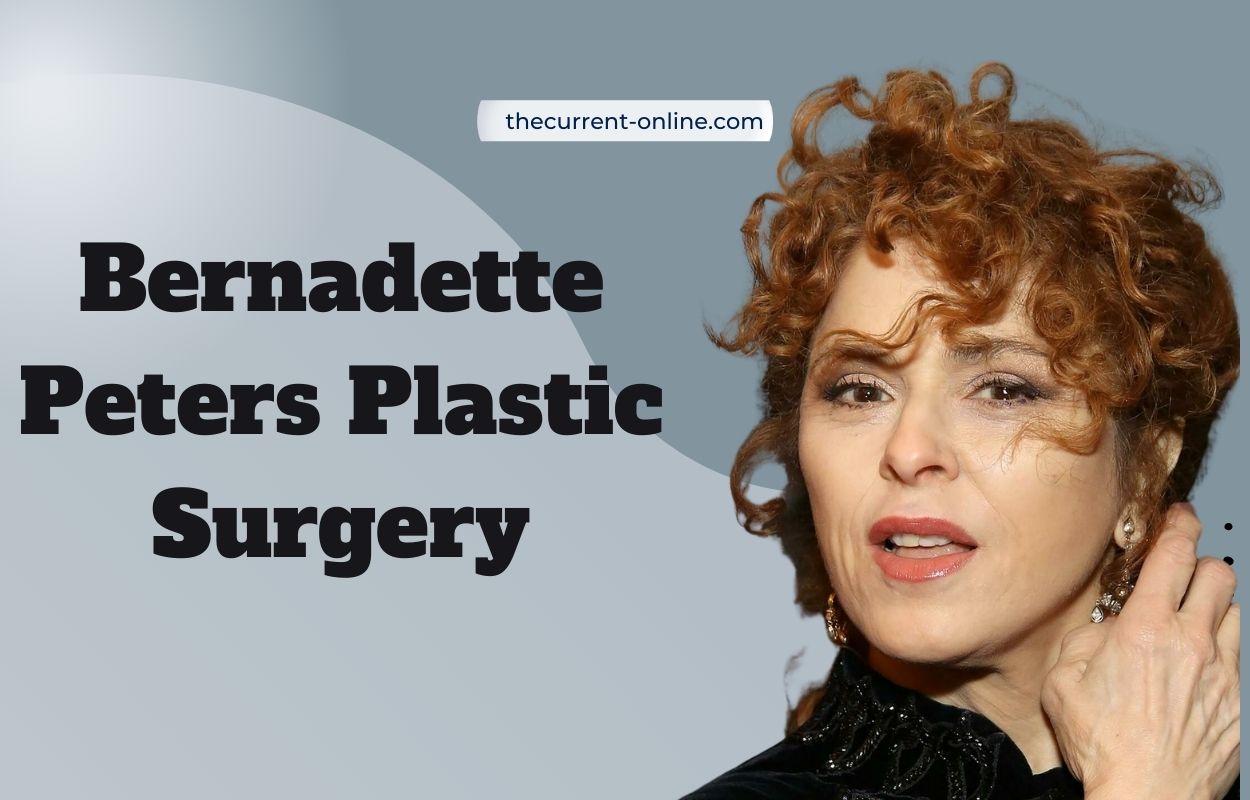 Bernadette Peters Plastic Surgery