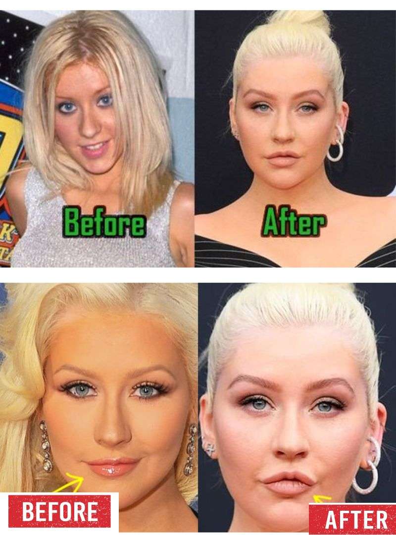 Christina Aguilera Before & After Pictures.