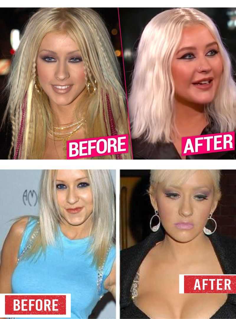 Christina Aguilera Before & After Pictures