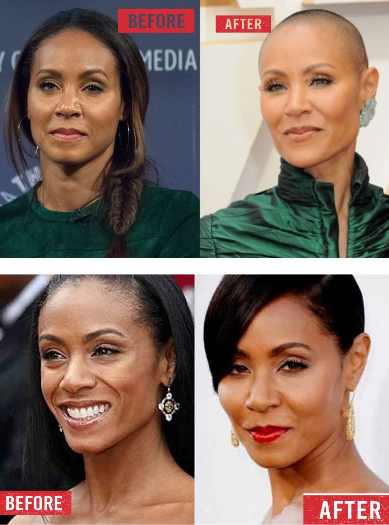 Jada Pinkett Before And After Pictures