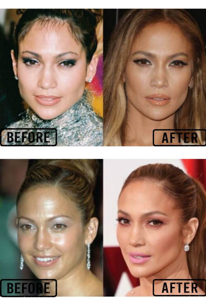 Jennifer Lopez Before And After Picture