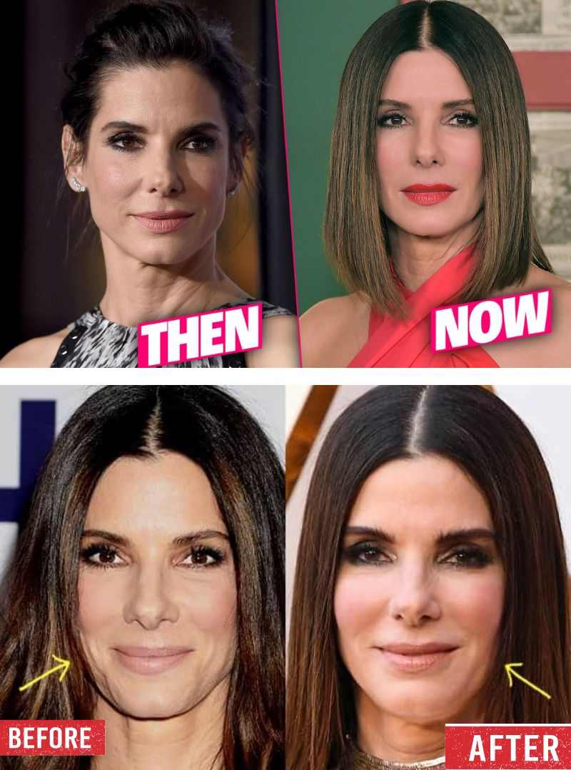 Sandra Bullock Before & After Pictures