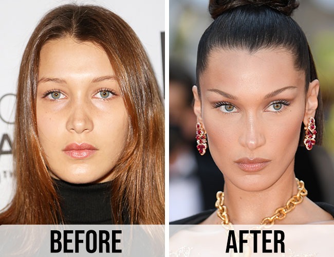 bella-hadid-before-after-front