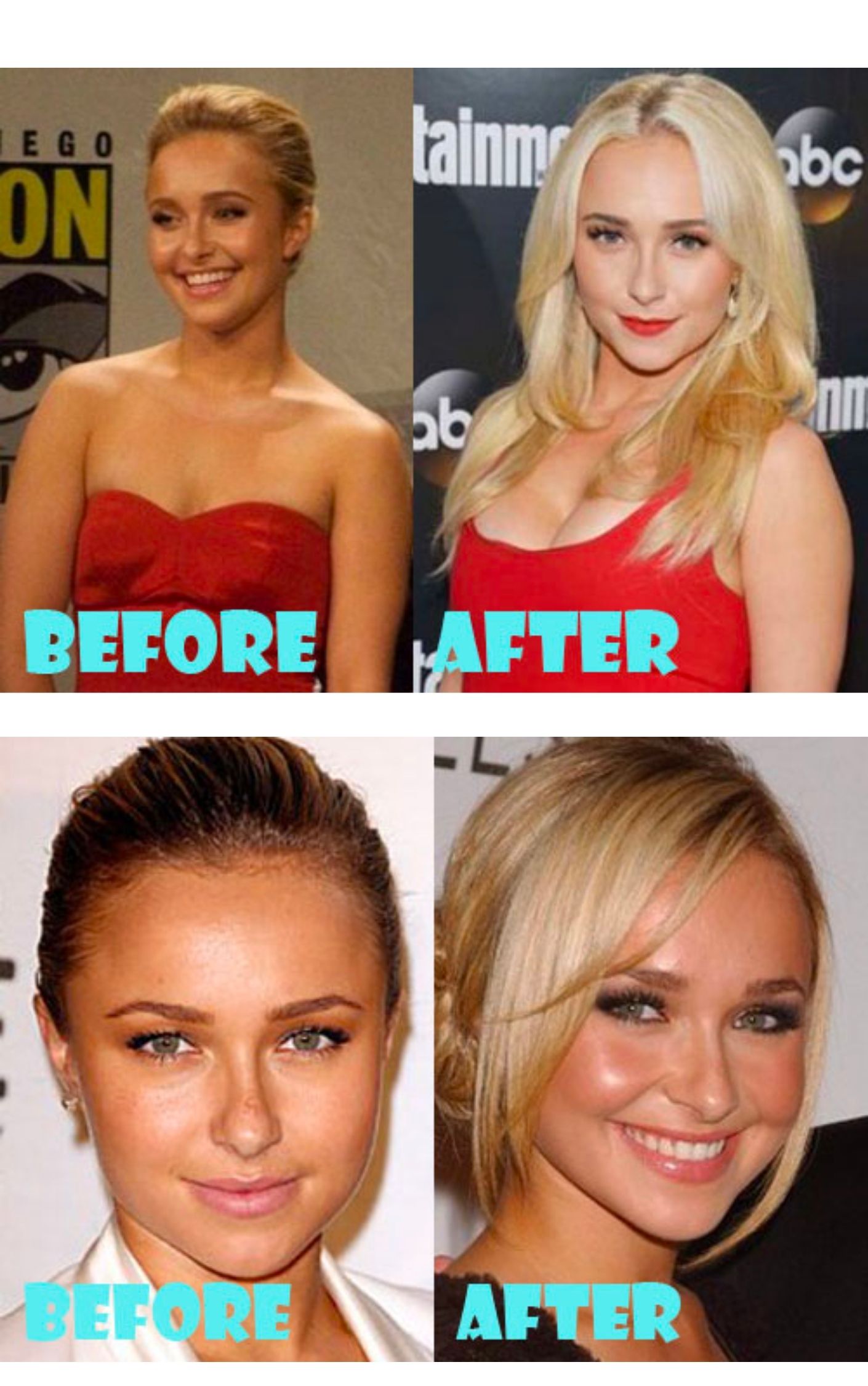 hayden panettiere before and after