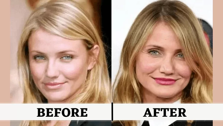 Cameron Diaz Before And After Pictures