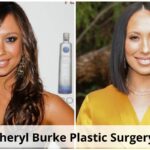 Cheryl Burke Plastic Surgery