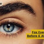 Fox Eye Before & After