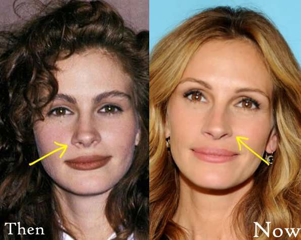 Julia Roberts Before And After Pictures